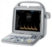 Ультразвукова діагностична система  Apogee 5500V (Pluse)