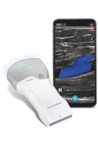 Система ультразвукова діагностична (УЗД)  портативна  Vscan AIR